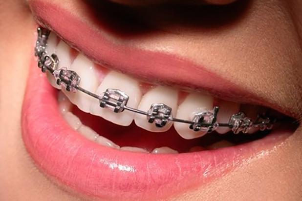 Qui connaît un bon orthodontiste à Grenoble qui s'y prend bien avec les enfants ? Mon fils va devoir porter un appareil, à mon avis, mais il a déjà une peur bleue du dentiste habituel...