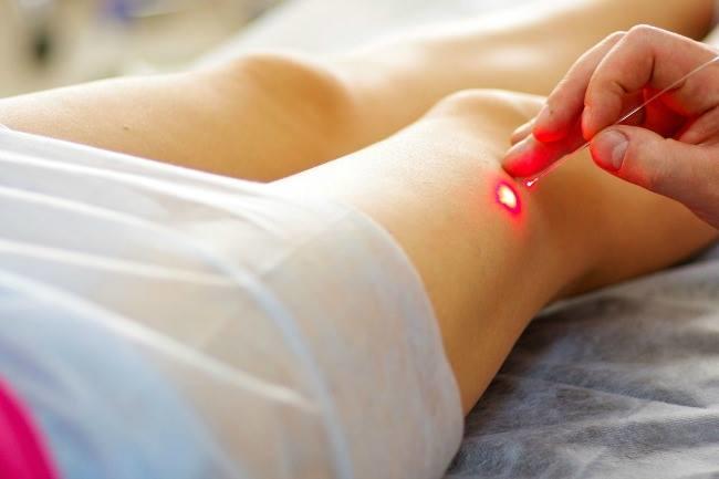 Qui connaît LE meilleur angiologue de Lille, spécialiste de la médecine vasculaire ?